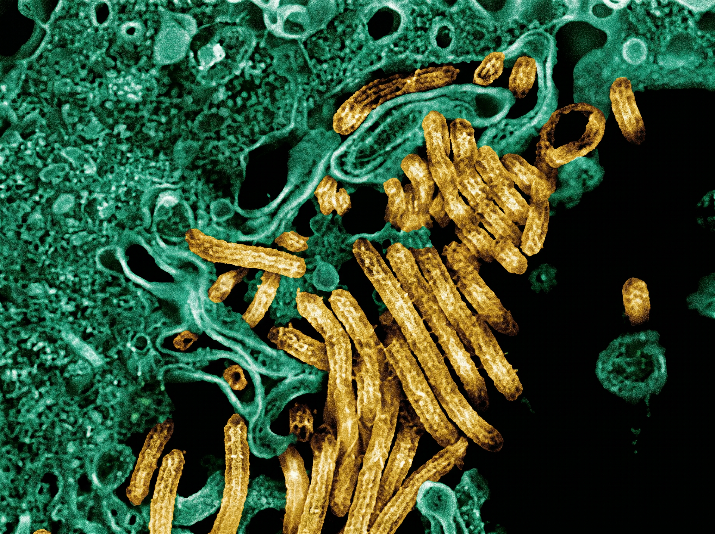 New Ebola Outbreak Claims Lives in Eastern Democratic Republic of Congo