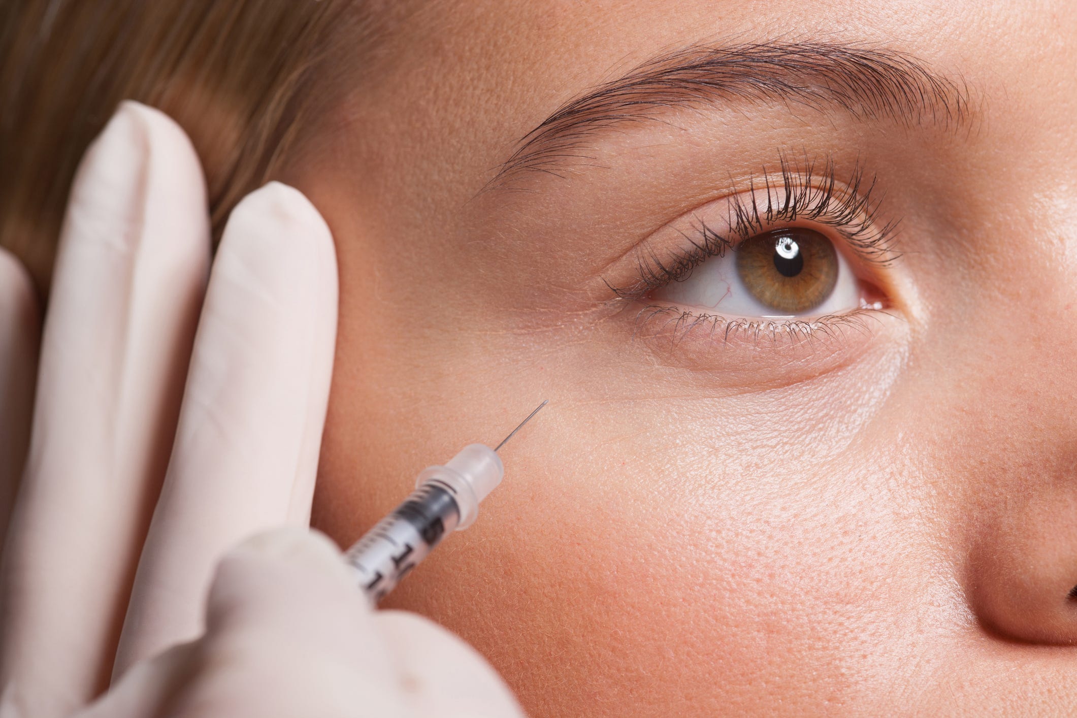 Botox Takes on Breakouts: A Revolutionary Acne Treatment