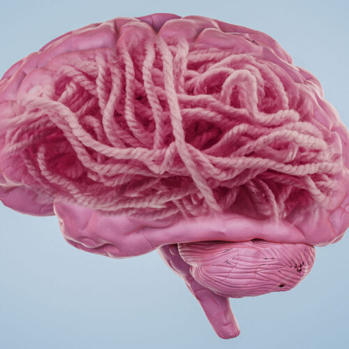 Concerns Emerge Over Amyloid-β Protein’s Role in Alzheimer’s Disease Following Research Retractations