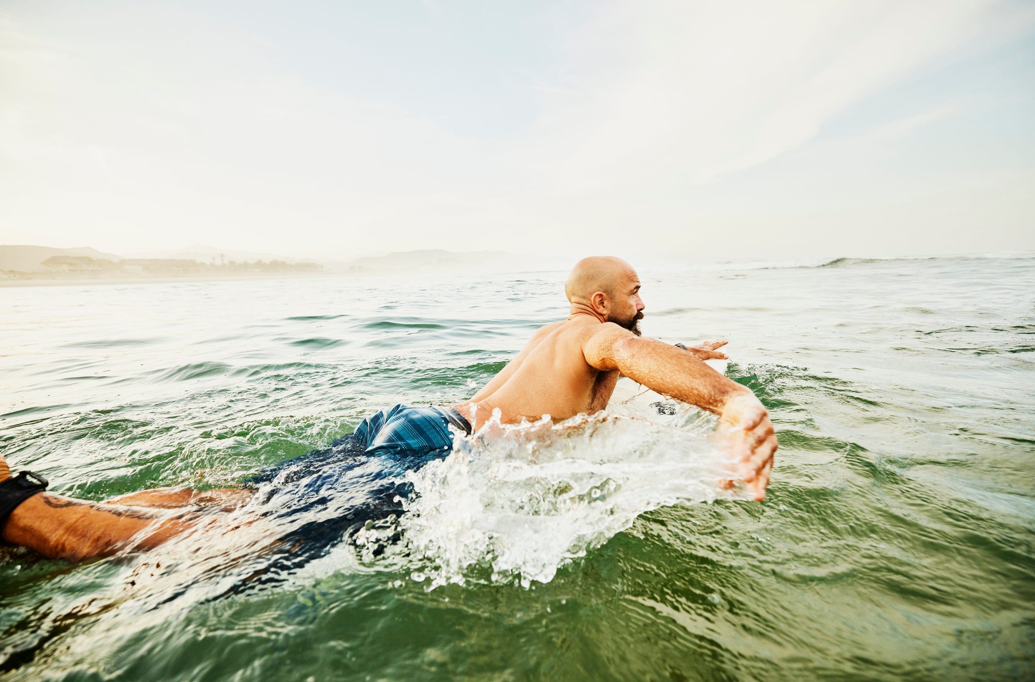 Link Between Early Male Baldness and Family Metabolic Health Explained